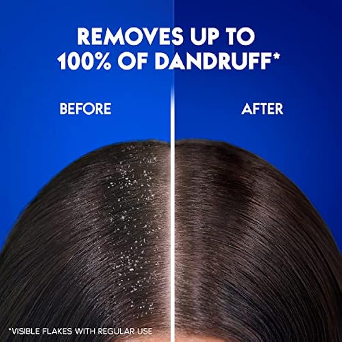Head & Shoulders Menthol Refresh Anti-Dandruff Shampoo for Itchy Scalp, 2 x 400ml - Image 2